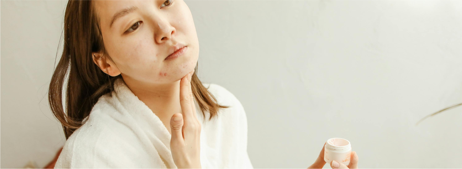 What is acne?